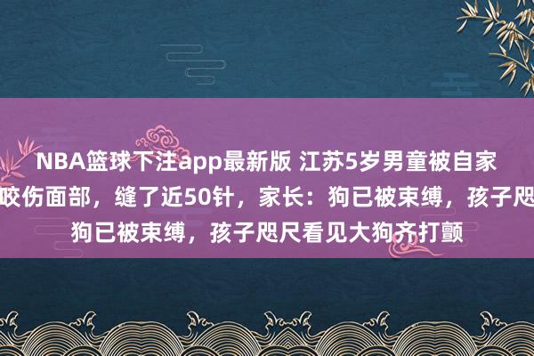NBA篮球下注app最新版 江苏5岁男童被自家养了几年的哈士奇咬伤面部，缝了近50针，家长：狗已被束缚，孩子咫尺看见大狗齐打颤